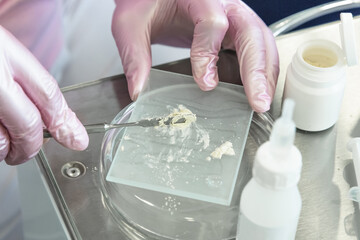 Close-up of the hands of a doctor kneading a solution in a dental clinic. Health care and treatment...