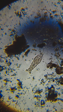 Mycetozoa Slime Mold And Purple Sulfur Bacteria PSB In Dead Shell Of Ostracod Under Compound Microscope.