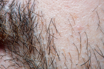 A close-up of a part of male skin with partially shaved facial hair with a strong magnification under a microscope. Clearly visible sections on the hair and pores of the skin.