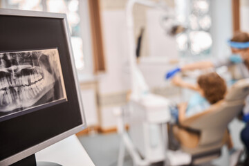 Dental treatment requires having a jaw x-ray