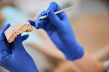 Plaster model of a jaw under dentist inspection