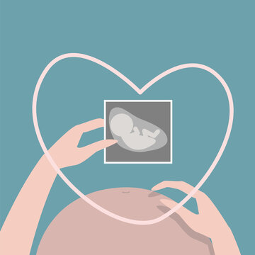 Illustration of a pregnant woman holding an ultrasound image of the fetus against the background of the abdomen. Belly of a pregnant woman, hands holding a picture of the child on ultrasound.
