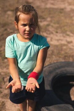 Girl showing her injured hands at a bootcamp