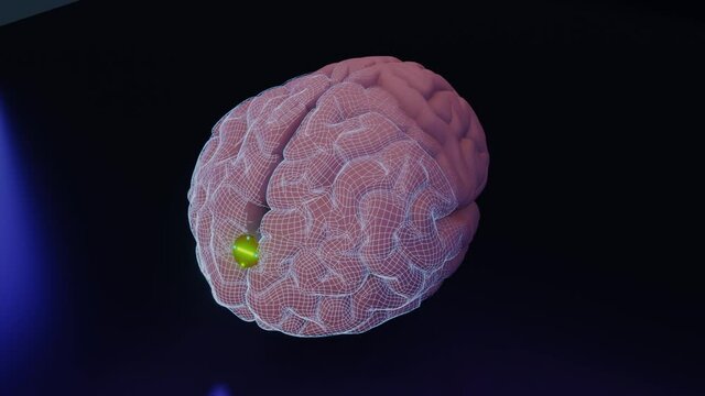 Shows off a working brain implant