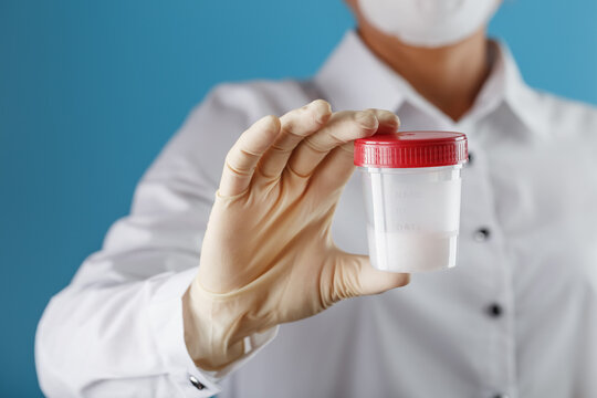 Semen analysis in a Bank is held in the hand of a doctor. Infertility.