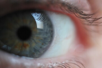 blue eye closeup with orange flecks in iris 