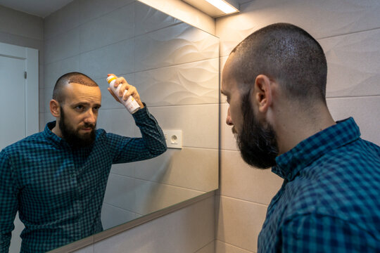 Man taking care his head with a spray after a hair implant