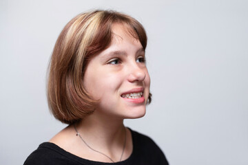 Beautiful young teenage girl smiles on a light background and shows that she has not straight teeth and malocclusion, soon she will be supplied with braces for teeth alignment