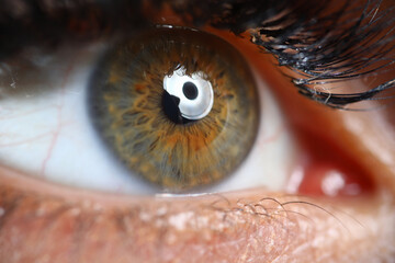 Female green-brown eye close up. Professional laser vision correction.