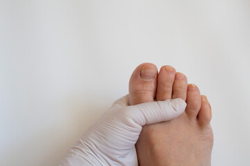 Naklejka premium Preparing for a pedicure. Women's foot to pedicure on a white background. Preparation of the foot skin and foot nails for pedicure. Pedicure before/after