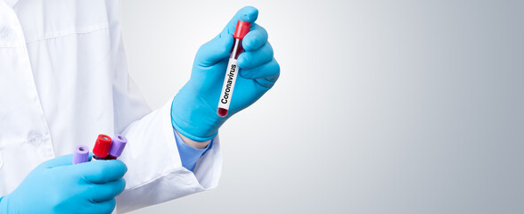 Coronavirus 2019-nCoV Blood Sample.