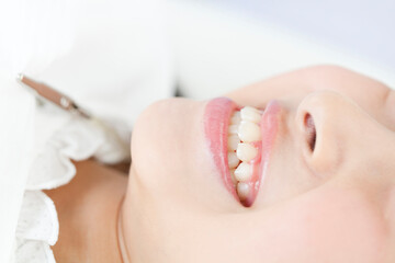 Obraz na płótnie Canvas 歯の治療を受ける女性