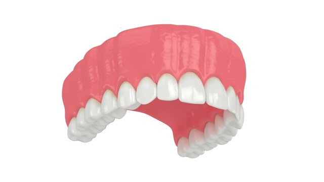 Upper jaw with abnormal teeth position. Orthodontic treatment concept. 