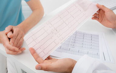 Doctor analyzes the electrocardiogram results, close-up. Diagnosis of arrhythmia, heart rate and...
