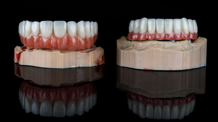 two dentures of the upper and lower jaw on models, filmed on black glass with reflection