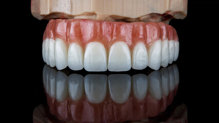 dental prosthesis on a resin model on black glass with reflection