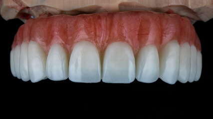 two dental prostheses on models in bite on a black background, side view