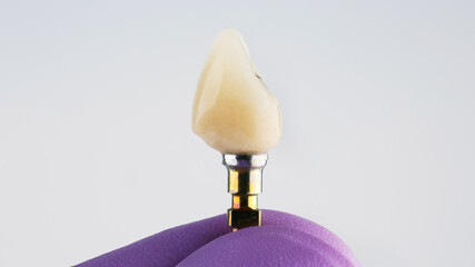 dentist holding a crown in a glove on a white background, side view of the crown