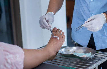 nurse is clean wound.