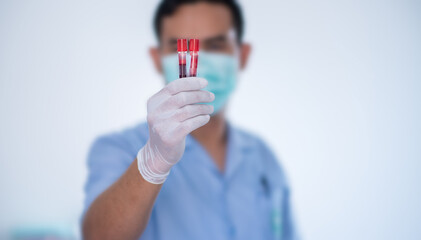 Close up of doctor hand holding blood sample. Copy space in left side