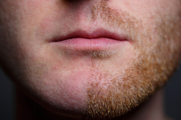 Fototapeta premium Young man shaving his beard. He shaved off half the bristles against a gray background. Male face care. Shaving bristles. The difference between skin without hair and with a mustache