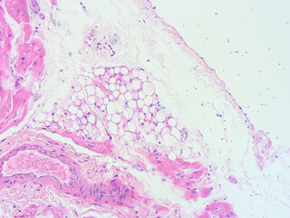 Fototapeta na wymiar picture of histology human tissue with microscope from laboratory (not Illustration Designation)