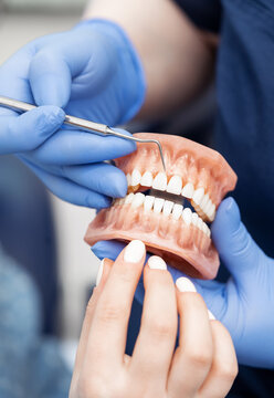 The dentist's hand holds an artificial jaw mock-up and shows the patient's teeth. Treatment in a dental clinic. Close-up.