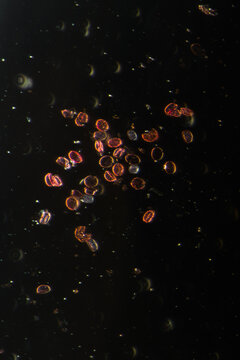 Eggs of the parasite roundworm