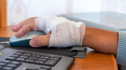 A man with a bandaged hand works at a computer