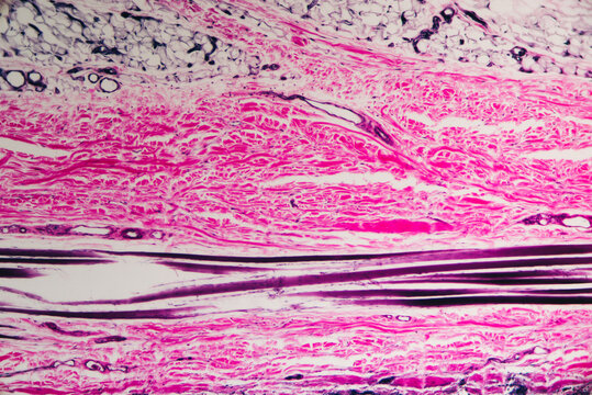 Human skin hair follicle section