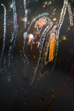 Moss reproductive parts Polytrichum Antheridia