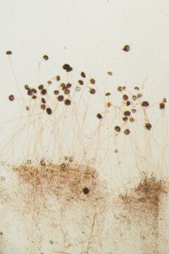 Aspergillus fungus