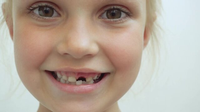 Blond beautiful girl 5 years old smiles without a milk tooth. Portrait of a toothless child