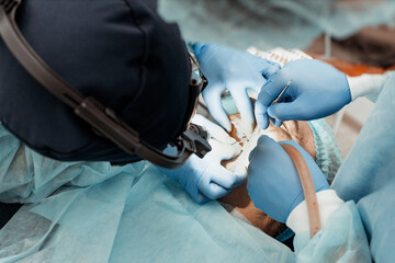 Dentists will perform an operation, implant placement. Real operation. Tooth extraction, implants. Professional uniform and equipment of a dentist. Healthcare Equipping a doctor’s workplace. Dentistry
