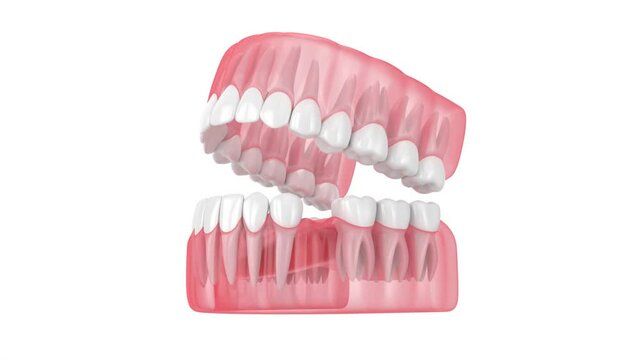 Teeth sliding towards the area of missing tooth. Consequences of tooth loss. 