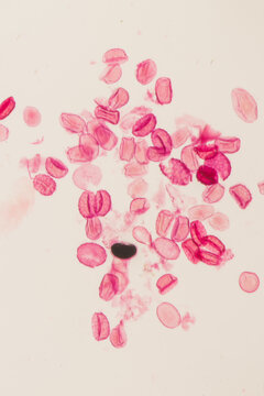 Eggs of the parasite roundworm