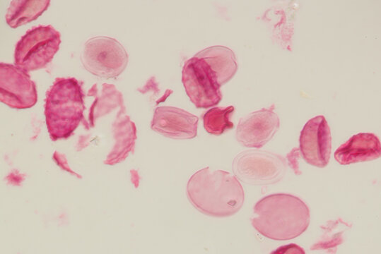 Eggs of the parasite roundworm