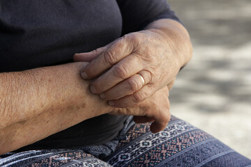 Elderly caucasian woman scratching dry skin on her arm. Senior dry skin problem.
