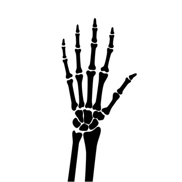 Arthrits x ray