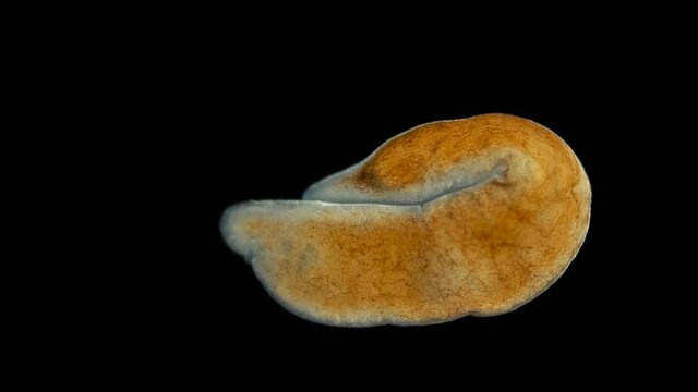 Nemertea worm under the microscope, supertype Spiralia, vast majority of predators, also scavengers, found in the Barents Sea