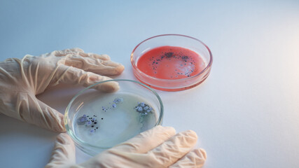 Research of viruses and bacteria, researcher holds a Petri dish with a sample.