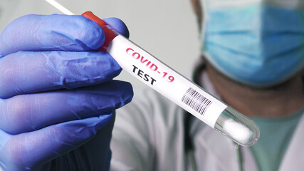 Medical has a PCR test Coronavirus COVID-19, collection process nasal samples NP and OP oral, viral...