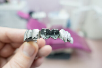 metal dental bridge