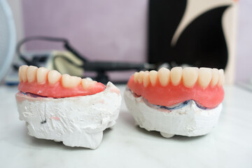 complete removable dental prostheses on gypsum models