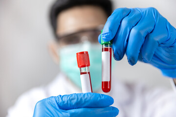 Doctor holding virus blood test tube