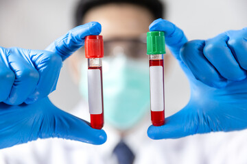 Doctor holding virus blood test tube