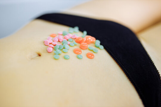 Hair removal with hot wax in bilini zone area