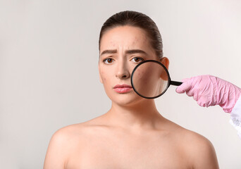 Doctor examining young woman with acne problem on white background