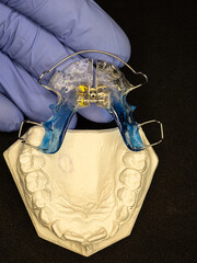 Dentist test setting of palatal braces for young patient. Gypsum copy of children upper jaw. © rdonar