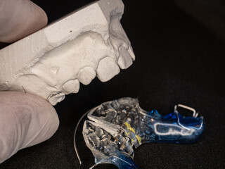 Plaster copy and new orthodontic removable retainer © rdonar